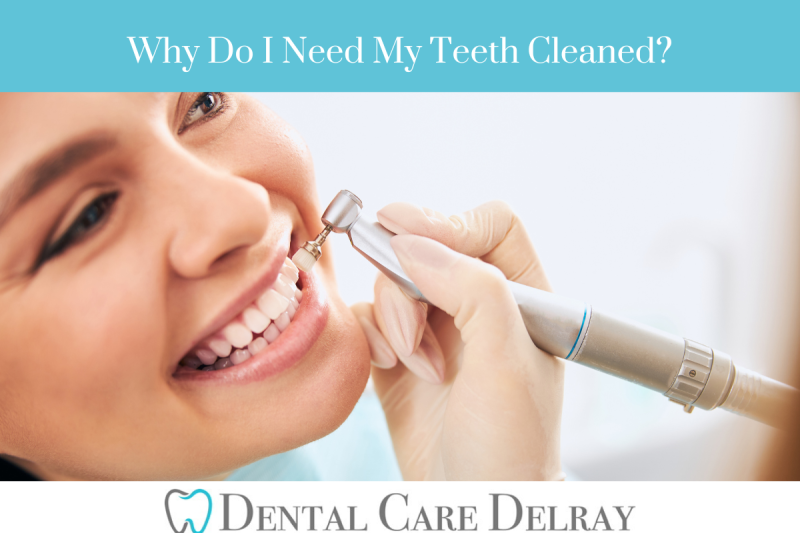 Why Do I Need My Teeth Cleaned?