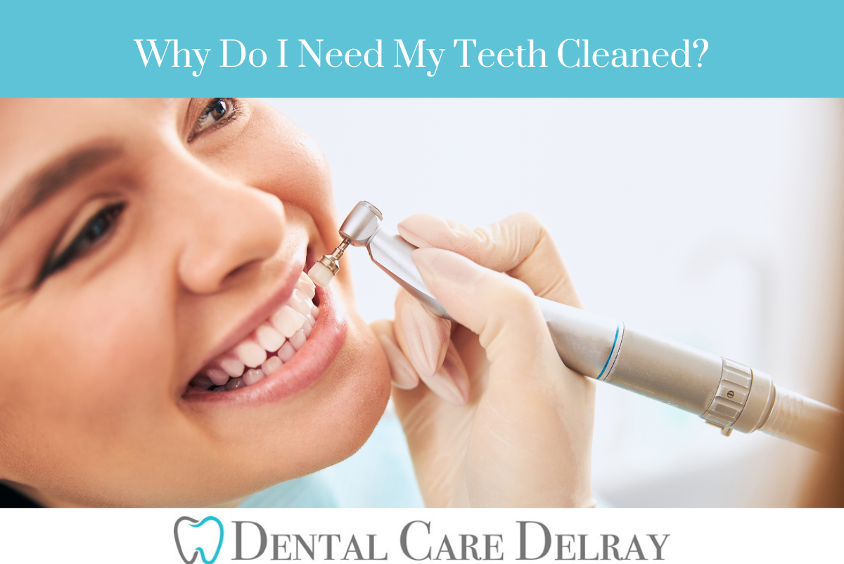 Why Do I Need My Teeth Cleaned?